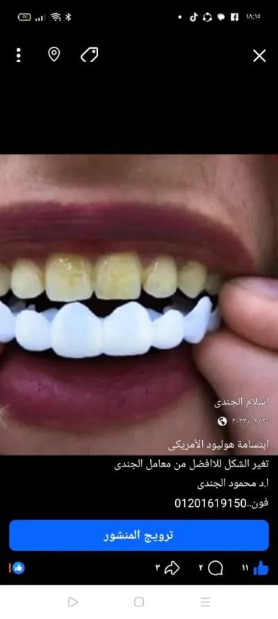 معمل أسنان الجندى تركيبات ثابتة ومتحركة
