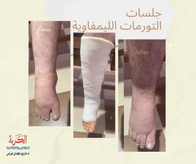 دكتور ماريو مجدي عزمي استشاري العلاج الطبيعي والتغذية العلاجية