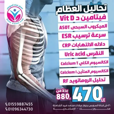 معامل قناة السويس للتحاليل الطبية