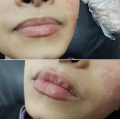 مركز دكتورة فاطمة محمود عبد الله جلدية وتجميل وليزر