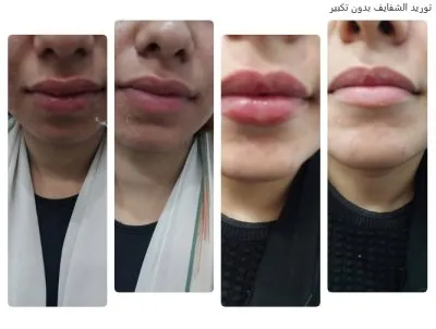 مركز دكتورة فاطمة محمود عبد الله جلدية وتجميل وليزر