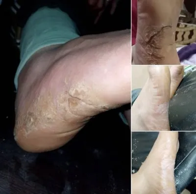 مركز دكتورة فاطمة محمود عبد الله جلدية وتجميل وليزر