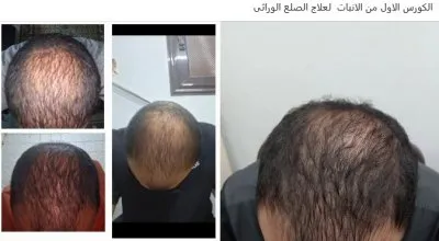 مركز دكتورة فاطمة محمود عبد الله جلدية وتجميل وليزر