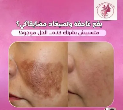 دكتورة ولاء عبد الهادي استشاري الأمراض الجلدية والتجميل