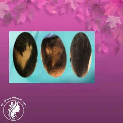 دكتورة ولاء عبد الهادي استشاري الأمراض الجلدية والتجميل
