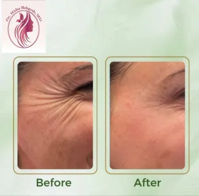 دكتورة ولاء عبد الهادي استشاري الأمراض الجلدية والتجميل