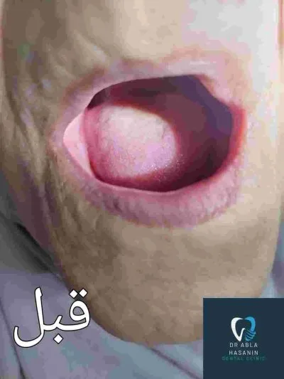 دكتورة عبلة حسنين الهالوصي أخصائي تجميل وجراحة الفم والأسنان