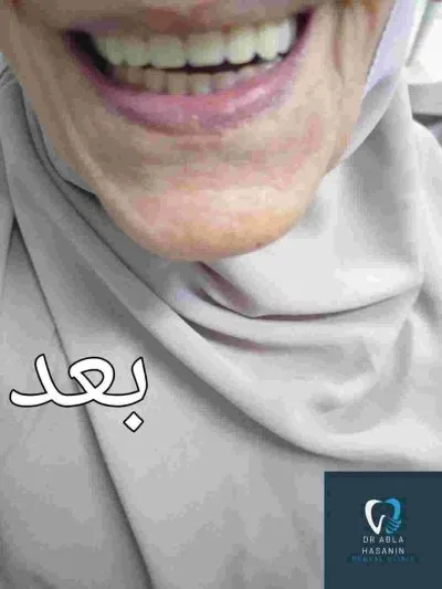 دكتورة عبلة حسنين الهالوصي أخصائي تجميل وجراحة الفم والأسنان