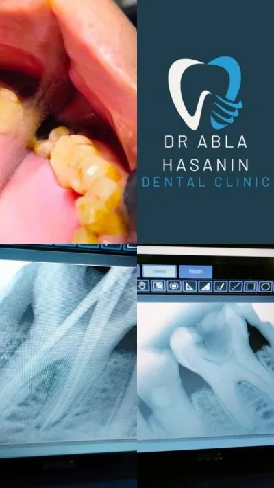 دكتورة عبلة حسنين الهالوصي أخصائي تجميل وجراحة الفم والأسنان