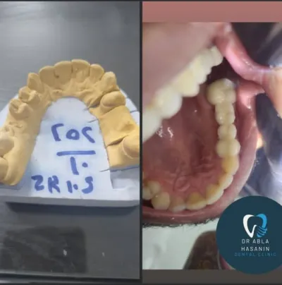 دكتورة عبلة حسنين الهالوصي أخصائي تجميل وجراحة الفم والأسنان