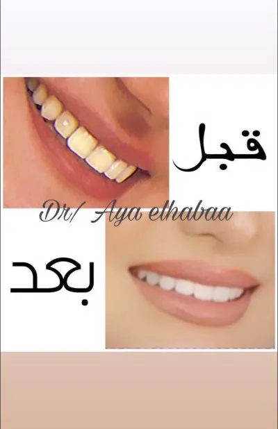 دكتورة آية جمال الهباء لطب وجراحة الفم والأسنان