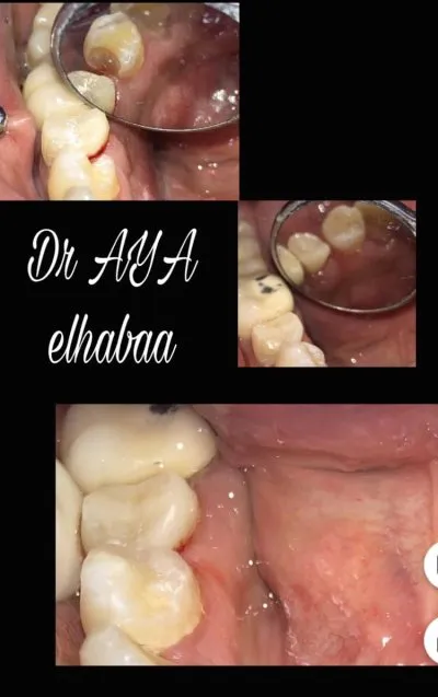 دكتورة آية جمال الهباء لطب وجراحة الفم والأسنان
