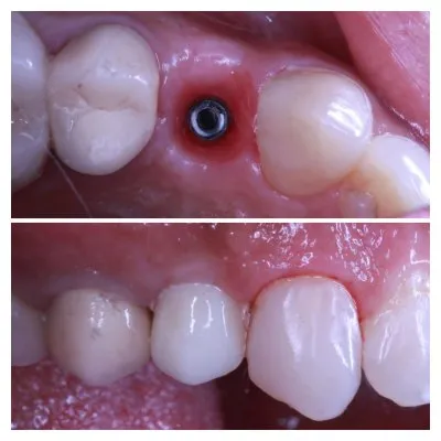 مركز بيور سمايل Pure Smile للاسنان