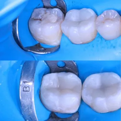 مركز بيور سمايل Pure Smile للاسنان