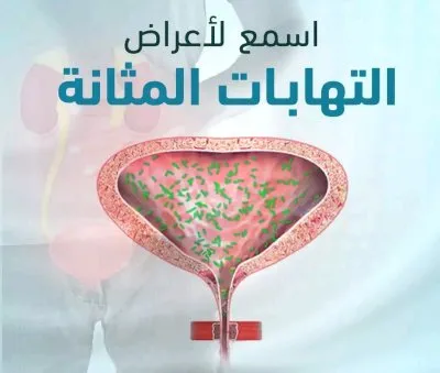 دكتور محمد كارم خليفة  استشاري المسالك البولية و الذكورة و العقم