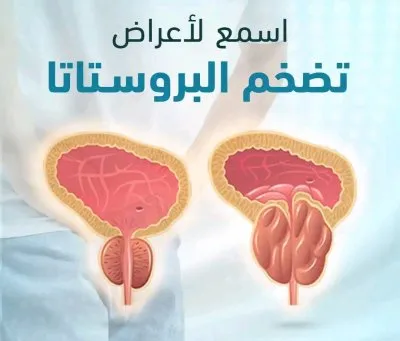 دكتور محمد كارم خليفة  استشاري المسالك البولية و الذكورة و العقم