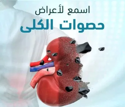 دكتور محمد كارم خليفة  استشاري المسالك البولية و الذكورة و العقم