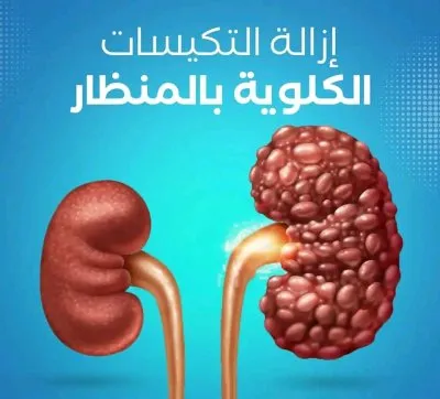 دكتور محمد كارم خليفة  استشاري المسالك البولية و الذكورة و العقم