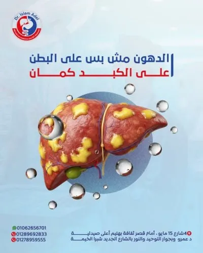 الأستاذ الدكتور إسلام عادل عواد إستشارى باطنة و جهاز هضمي و كبد