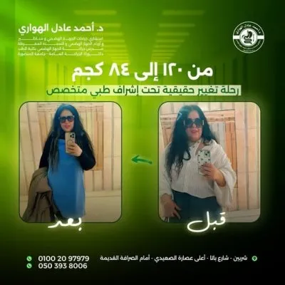 دكتور أحمد الهواري استشاري جراحة عامة وسمنة ومناظير