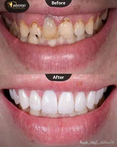 دكتور اسلام داوود لعلاج و تجميل الاسنان