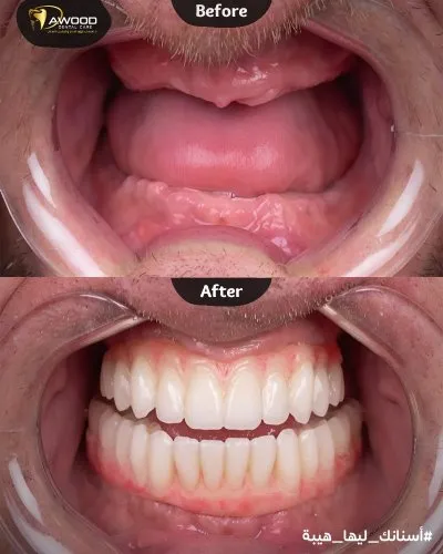 دكتور اسلام داوود لعلاج و تجميل الاسنان