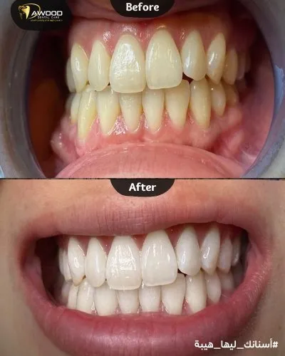 دكتور اسلام داوود لعلاج و تجميل الاسنان