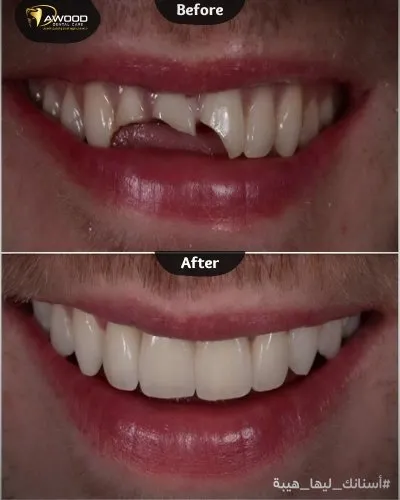 دكتور اسلام داوود لعلاج و تجميل الاسنان