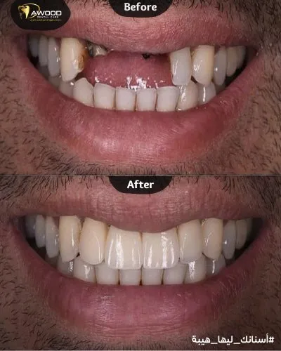 دكتور اسلام داوود لعلاج و تجميل الاسنان