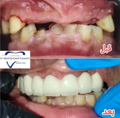 دكتور محمد عصام عبد العزيز أخصائي طب وجراحة الأسنان