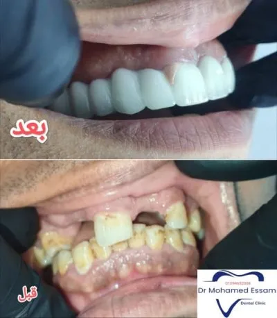 دكتور محمد عصام عبد العزيز أخصائي طب وجراحة الأسنان