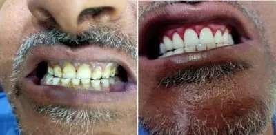 دكتور محمد احمد مدبولي أخصائي طب وجراحة الأسنان
