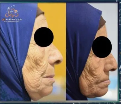 مركز الخليل دكتور محمد خليل مصطفى لتقويم و زراعة الاسنان