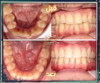 مركز الخليل دكتور محمد خليل مصطفى لتقويم و زراعة الاسنان