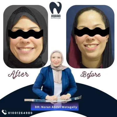 دكتورة نوران عبد المتجلي  استشاري تقويم الأسنان