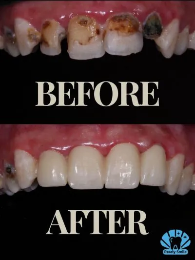 مركز بيرلي سمايل لطب الأسنان دكتورة أمل عامر