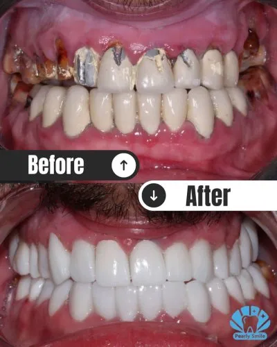 مركز بيرلي سمايل لطب الأسنان دكتورة أمل عامر