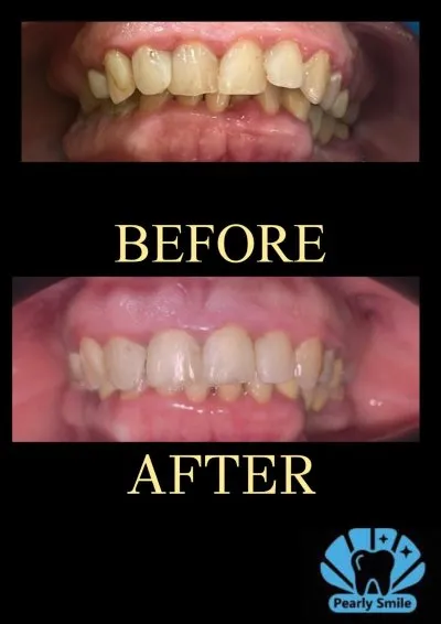 مركز بيرلي سمايل لطب الأسنان دكتورة أمل عامر