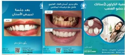 مركز بيرلي سمايل لطب الأسنان دكتورة أمل عامر
