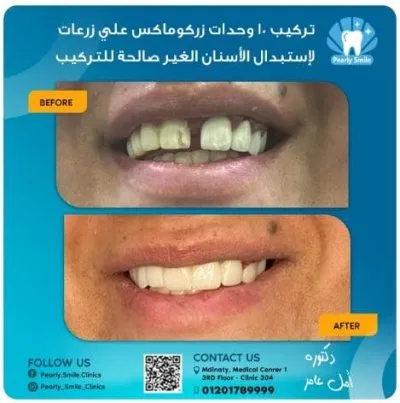 مركز بيرلي سمايل لطب الأسنان دكتورة أمل عامر