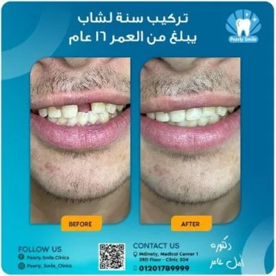 مركز بيرلي سمايل لطب الأسنان دكتورة أمل عامر
