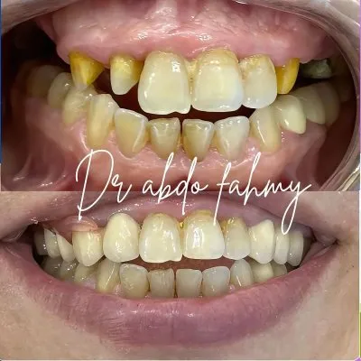 دكتور عبده فهمى لعلاج وتجميل الأسنان