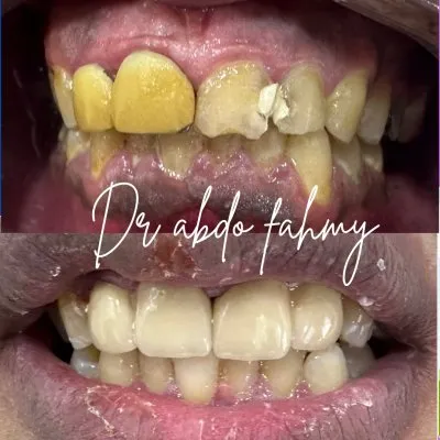 دكتور عبده فهمى لعلاج وتجميل الأسنان