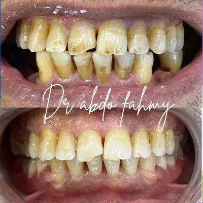 دكتور عبده فهمى لعلاج وتجميل الأسنان