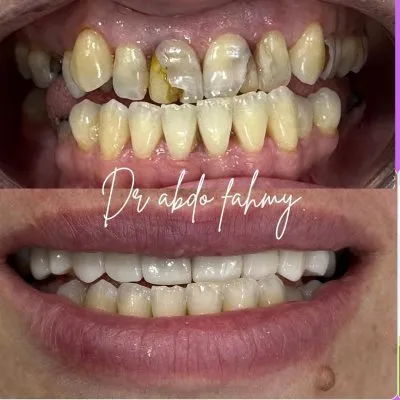 دكتور عبده فهمى لعلاج وتجميل الأسنان