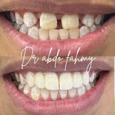 دكتور عبده فهمى لعلاج وتجميل الأسنان
