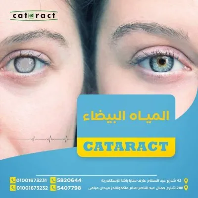 مستشفي معهد الكتاركت الدولى لطب وجراحة العيون