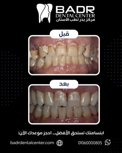 دكتور أحمد عبد الله بدر مركز بدر لطب الأسنان
