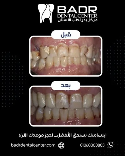 مركز بدر لطب الأسنان دكتور أحمد عبد الله بدر