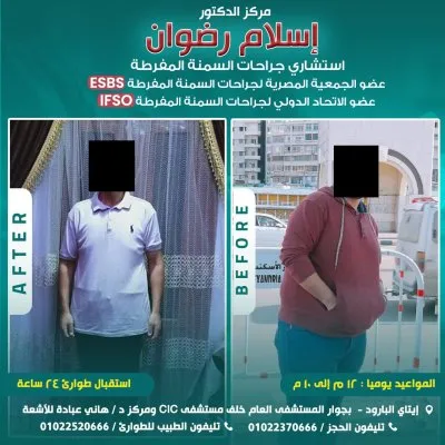 دكتور اسلام رضوان استشاري جراحة عامة ومناظير وسمنة مفرطة
